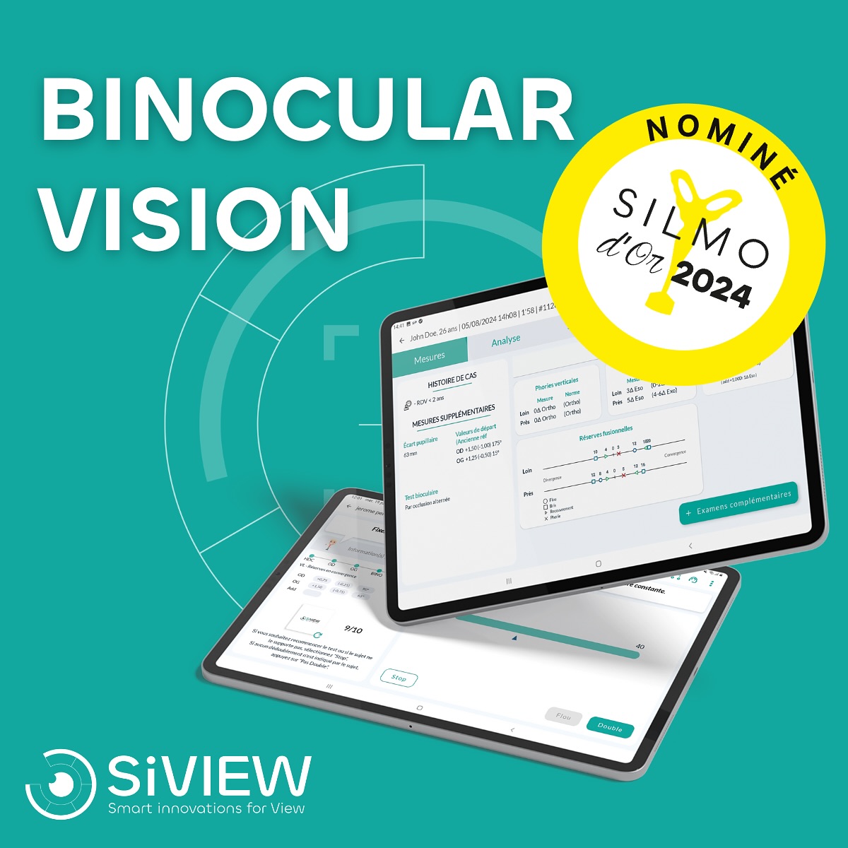 SiVIEW with « Binocular Vision » - FR